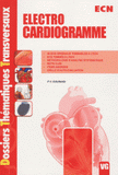 Electrocardiogramme